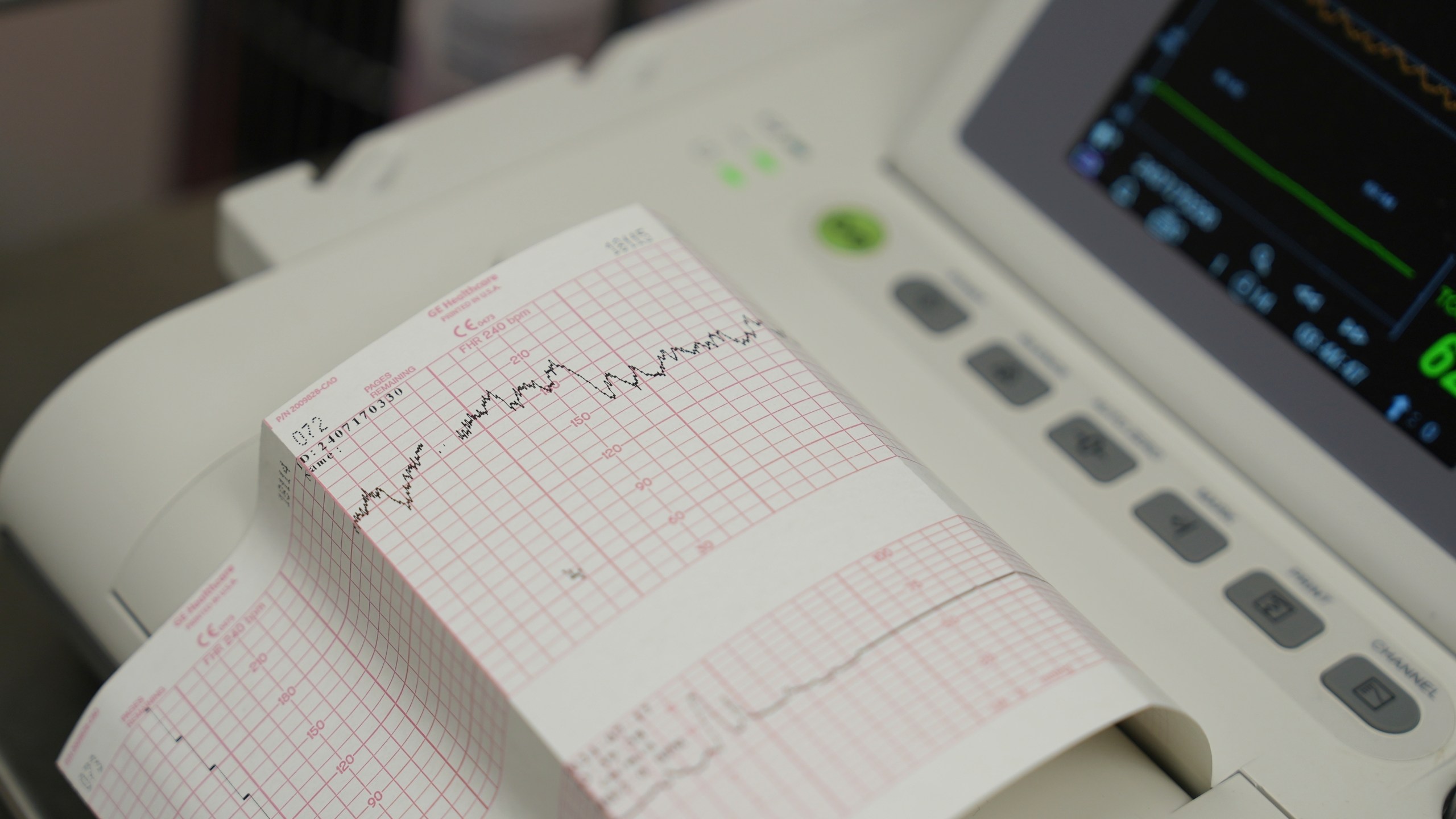 A cardiotocograph measures Denise Jones' contractions and her baby's heart rate during a prenatal appointment at the Oklahoma State University obstetrics and gynecology clinic in Tulsa, Okla., on Tuesday, July 16, 2024. (AP Photo/Mary Conlon)