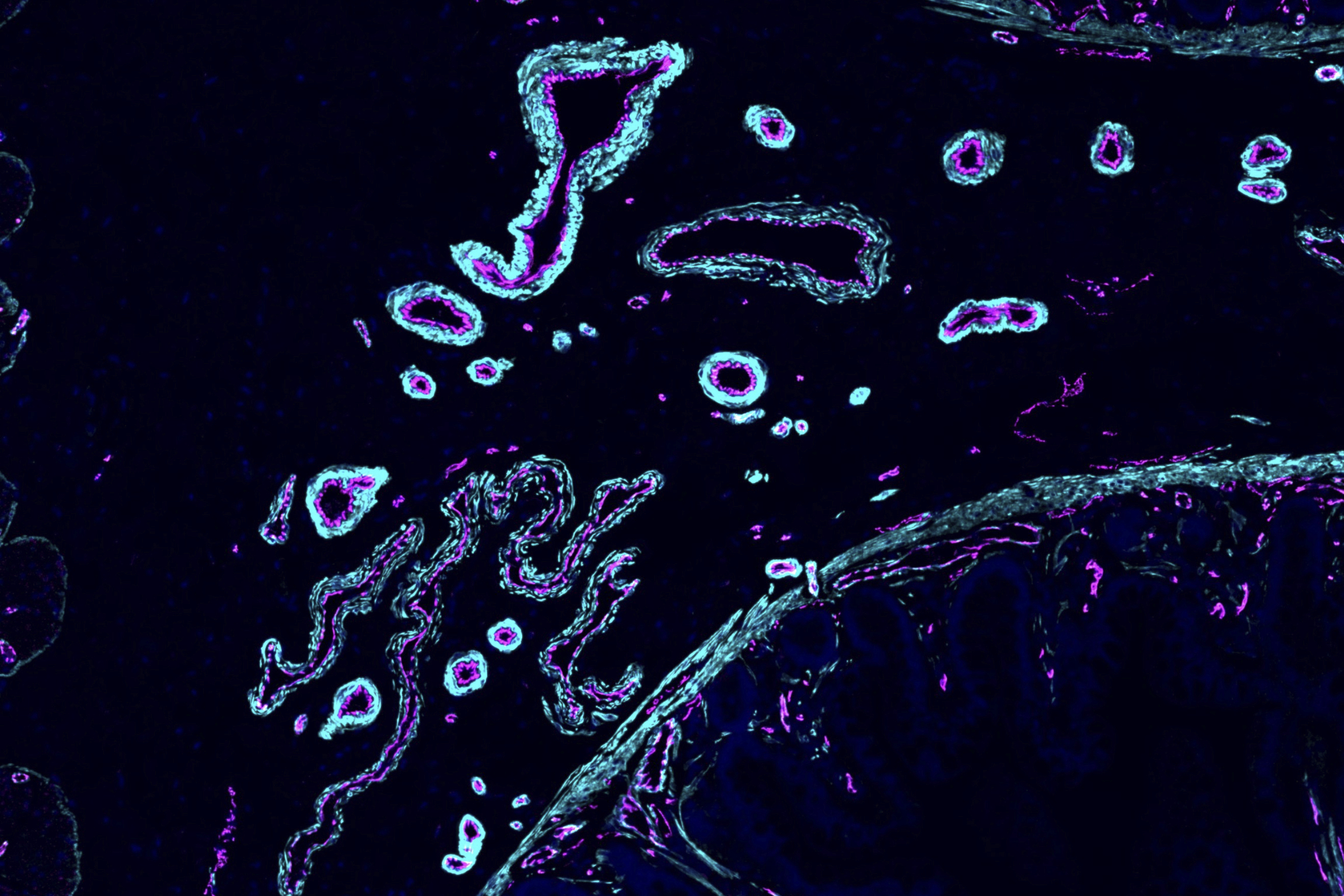 This image provided by Ana-Maria Cujba shows blood vessels in a portion of the human small intestine, March 21, 2024. (Ana-Maria Cujba/Wellcome Sanger Institute via AP)