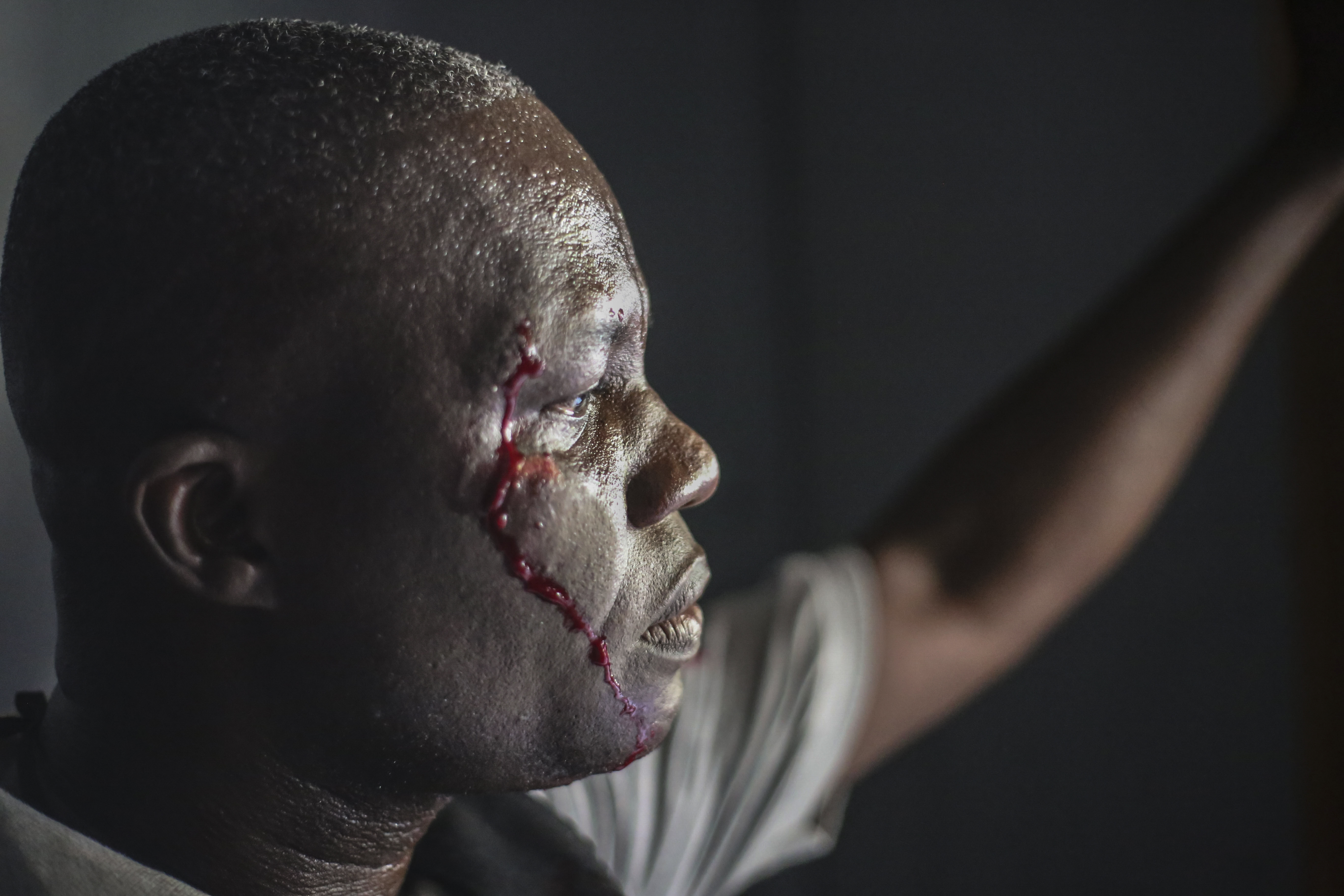 A wounded security officer looks on after being shot by armed gangs at the General Hospital in Port-au-Prince, Haiti, Tuesday, Dec. 24, 2024. (AP Photo/Jean Feguens Regala)