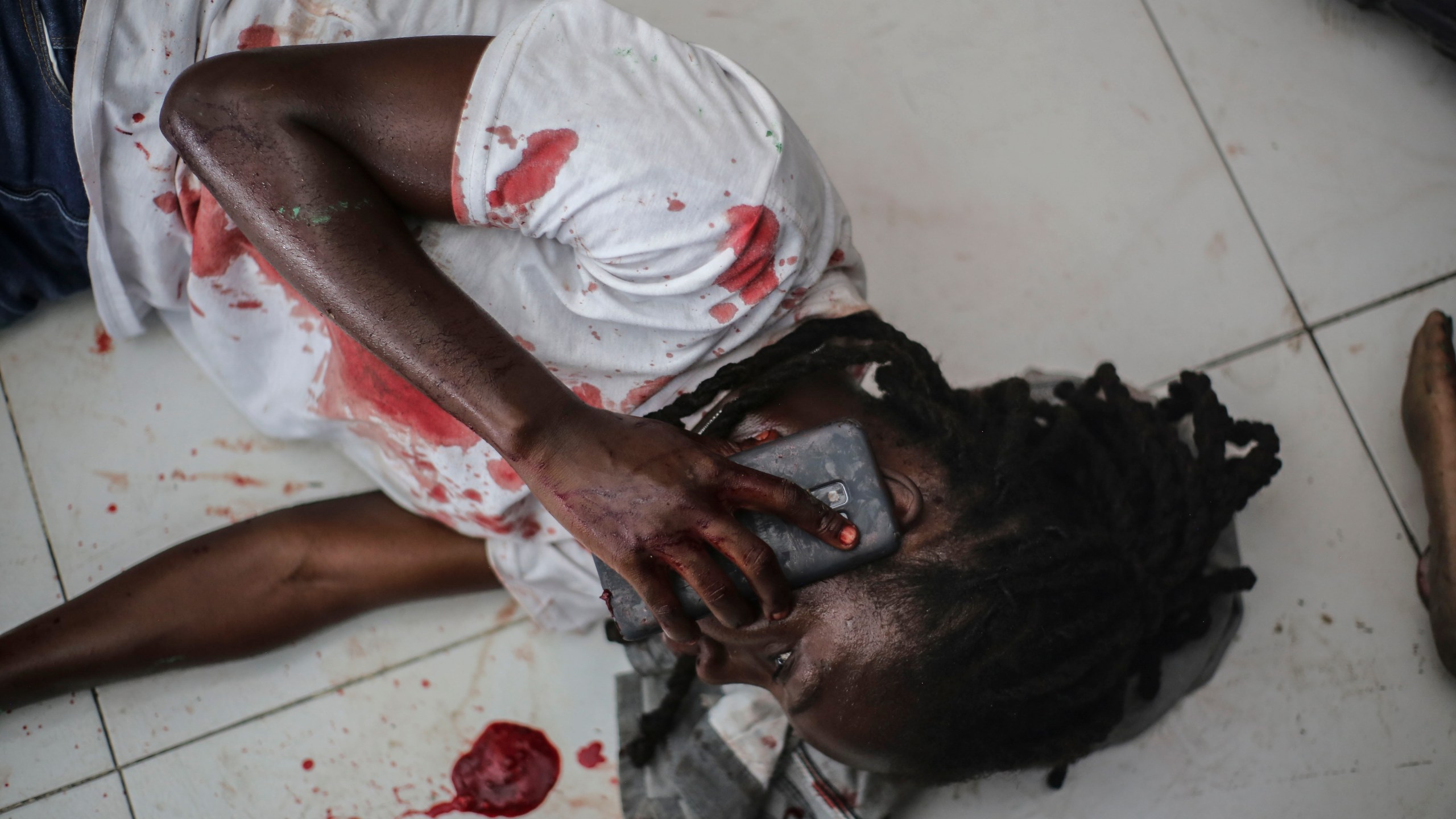 A wounded journalist talks on the phone after being shot by armed gangs at the General Hospital in Port-au-Prince, Haiti, Tuesday, Dec. 24, 2024. (AP Photo/Jean Feguens Regala)