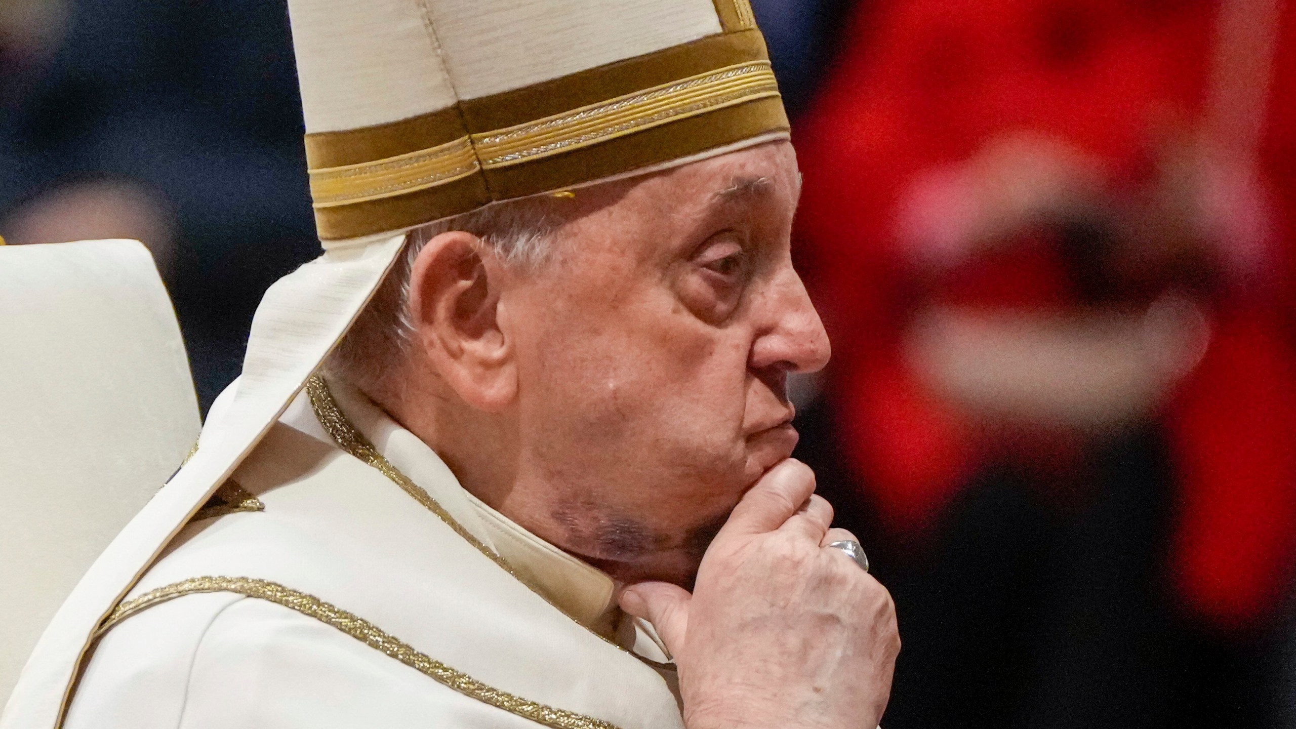 FILE - Pope Francis reacts during a solemn mass where he made 21 new cardinals in St. Peter's Basilica at The Vatican, Saturday, Dec. 7, 2024. (AP Photo/Gregorio Borgia, File)